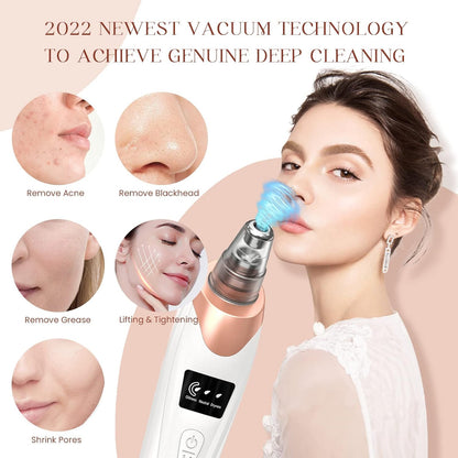 Blackhead Remover Pore Vacuum,Facial Pore Cleaner-5 Suction Power,5 Probes,USB Rechargeable Blackhead Vacuum Kit Electric Acne Extractor Tool for Adult